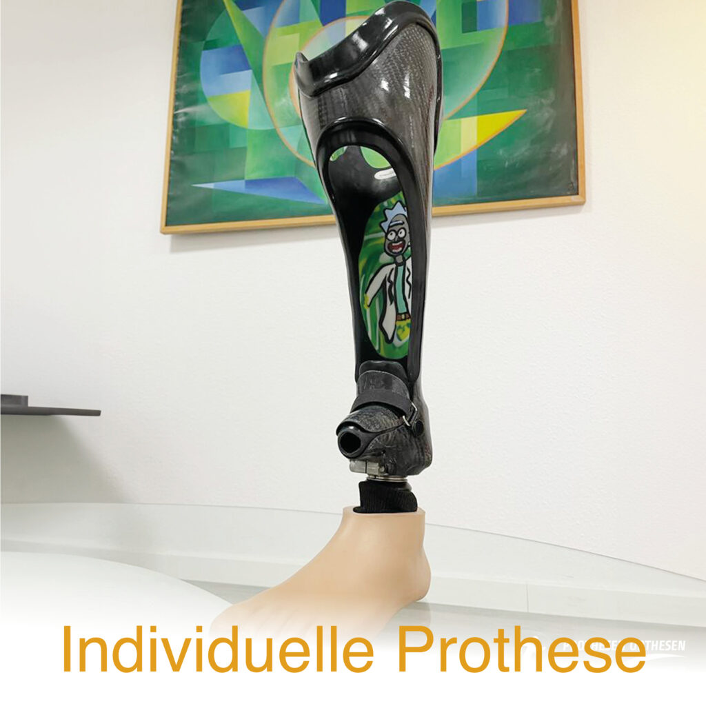 Individuelles Prothesendesign – Prothesen-Orthesenmanufaktur