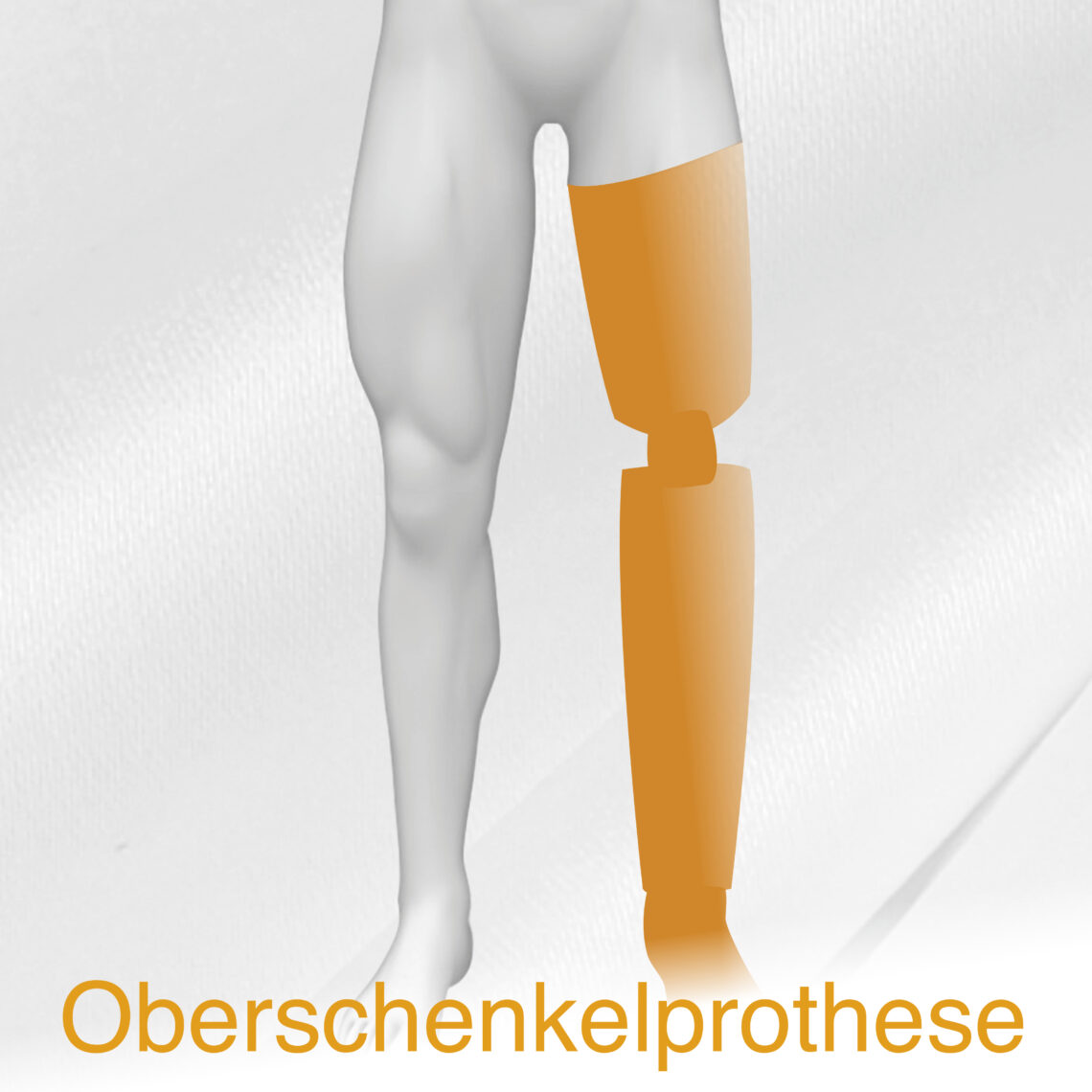 Prothesen – Prothesen-Orthesenmanufaktur